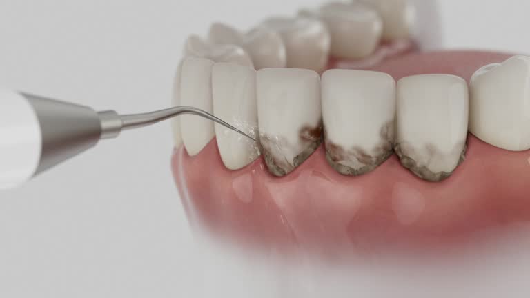 Reliable Dental Implants contractor in Inez, TX by Smile Center Dentistry
